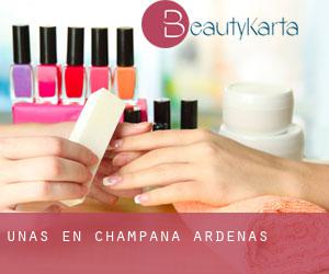 Uñas en Champaña-Ardenas Uñas en Champaña-Ardenas