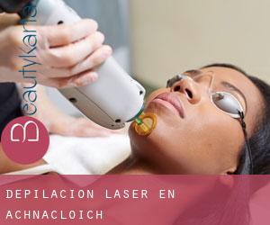 Depilación laser en Achnacloich