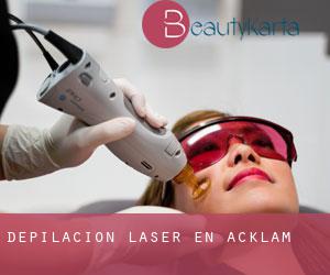 Depilación laser en Acklam
