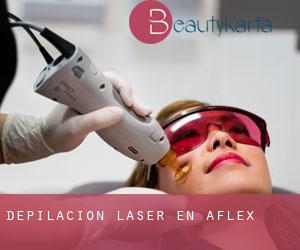 Depilación laser en Aflex