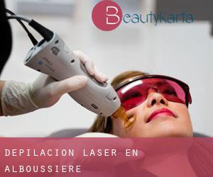 Depilación laser en Alboussière