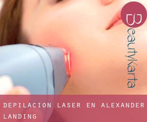 Depilación laser en Alexander Landing