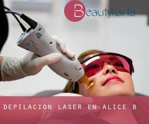 Depilación laser en Alice B