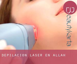 Depilación laser en Allah