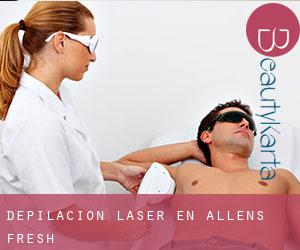 Depilación laser en Allens Fresh