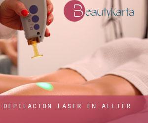 Depilación laser en Allier