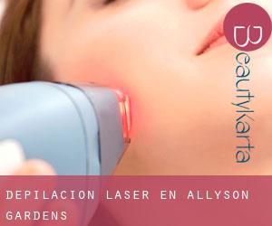 Depilación laser en Allyson Gardens