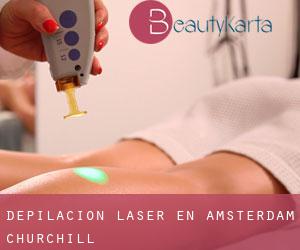 Depilación laser en Amsterdam-Churchill