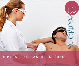 Depilación laser en Anfo