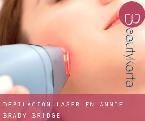 Depilación laser en Annie Brady Bridge