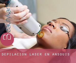 Depilación laser en Ansouis