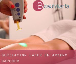 Depilación laser en Arzenc-d'Apcher