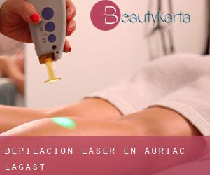 Depilación laser en Auriac-Lagast
