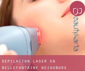 Depilación laser en Bellefontaine Neighbors