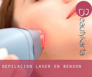 Depilación laser en Benson
