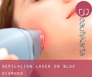Depilación laser en Blue Diamond