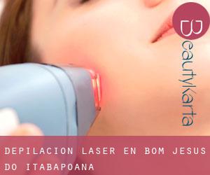 Depilación laser en Bom Jesus do Itabapoana