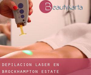 Depilación laser en Brockhampton Estate