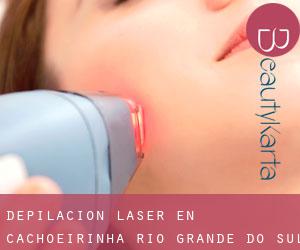 Depilación laser en Cachoeirinha (Rio Grande do Sul)