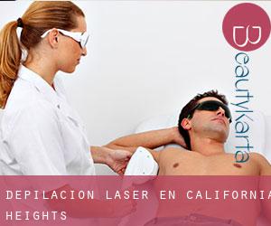 Depilación laser en California Heights