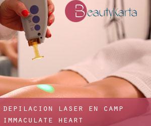Depilación laser en Camp Immaculate Heart