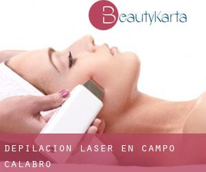 Depilación laser en Campo Calabro