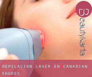 Depilación laser en Canadian Shores