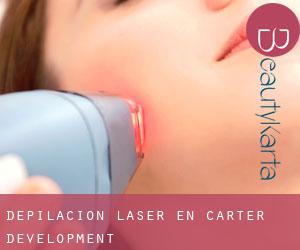 Depilación laser en Carter Development