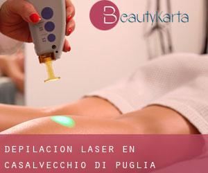 Depilación laser en Casalvecchio di Puglia