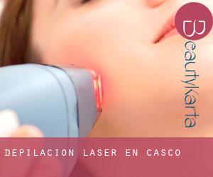 Depilación laser en Casco