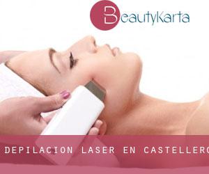 Depilación laser en Castellero