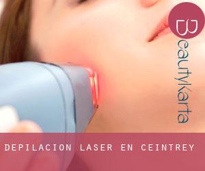 Depilación laser en Ceintrey