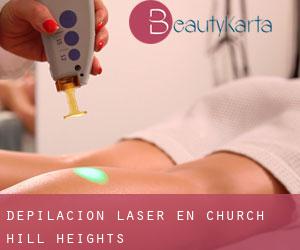 Depilación laser en Church Hill Heights