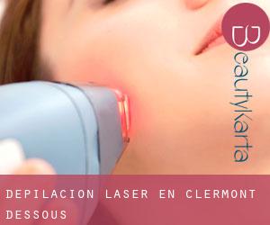 Depilación laser en Clermont-Dessous