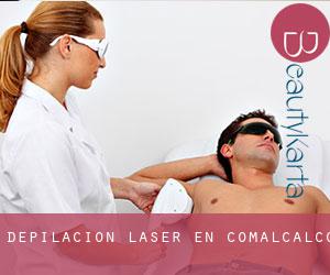 Depilación laser en Comalcalco