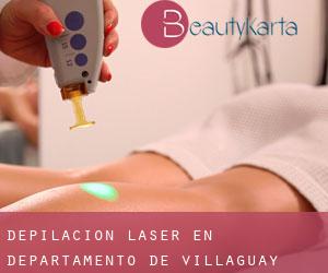 Depilación laser en Departamento de Villaguay