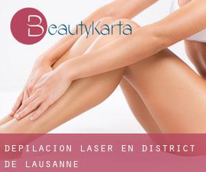 Depilación laser en District de Lausanne