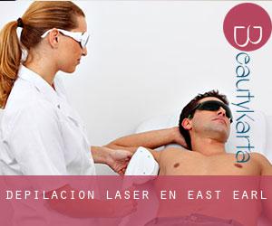 Depilación laser en East Earl