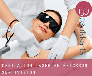 Depilación laser en Erickson Subdivision