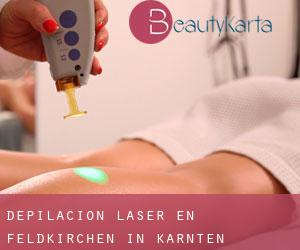 Depilación laser en Feldkirchen in Kärnten