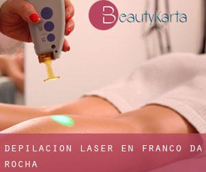 Depilación laser en Franco da Rocha