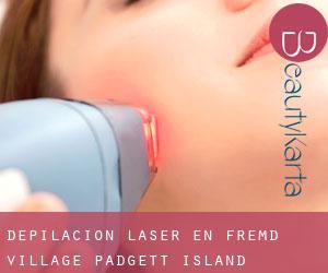 Depilación laser en Fremd Village-Padgett Island