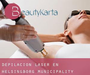 Depilación laser en Helsingborg Municipality