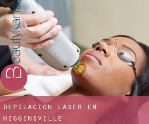 Depilación laser en Higginsville
