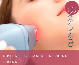 Depilación laser en Hoene Spring