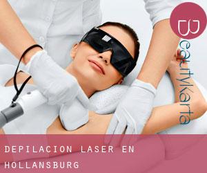 Depilación laser en Hollansburg