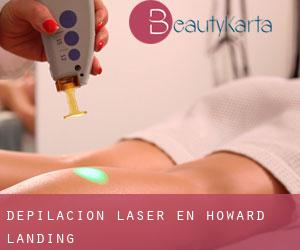 Depilación laser en Howard Landing