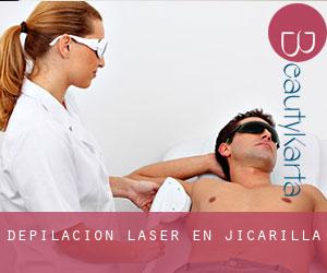 Depilación laser en Jicarilla