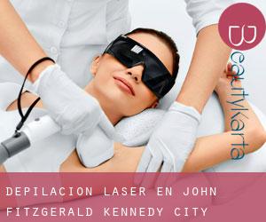 Depilación laser en John Fitzgerald Kennedy City