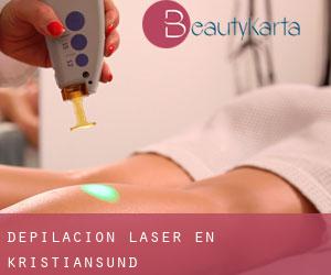 Depilación laser en Kristiansund